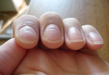 волнистые ногти на руках